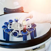 Plasma Reactor & Research Reactor